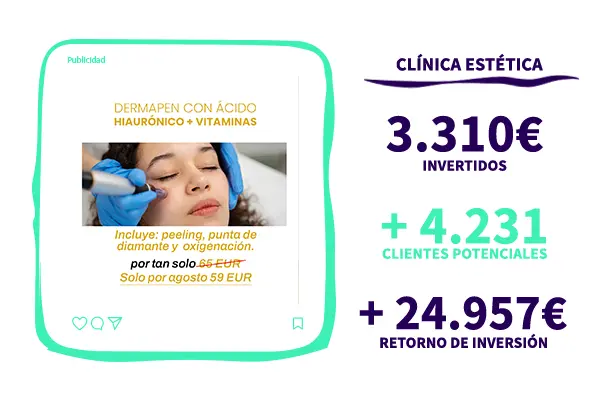 Retorno de inversion (ROI) En centros médicos estéticos en madrid , Pulso Marketing para estéticas