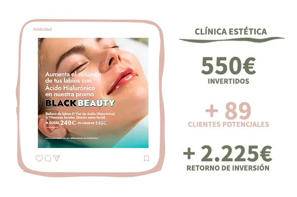 ROI en campañas de meta ads clientes potenciales , Tu agenda full, marketing para tatuadores, esteticistas, wellness