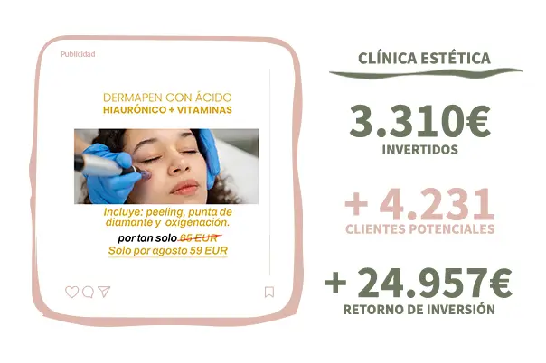 ROI en campañas de meta ads clientes potenciales , Tu agenda full, marketing para tatuadores, esteticistas, wellness