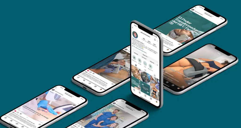 Múltiples teléfonos móviles mostrando el perfil de Instagram de Adansonia Centro Estético y sus publicaciones sobre tratamientos estéticos.